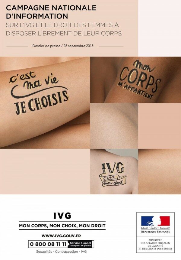 IVG